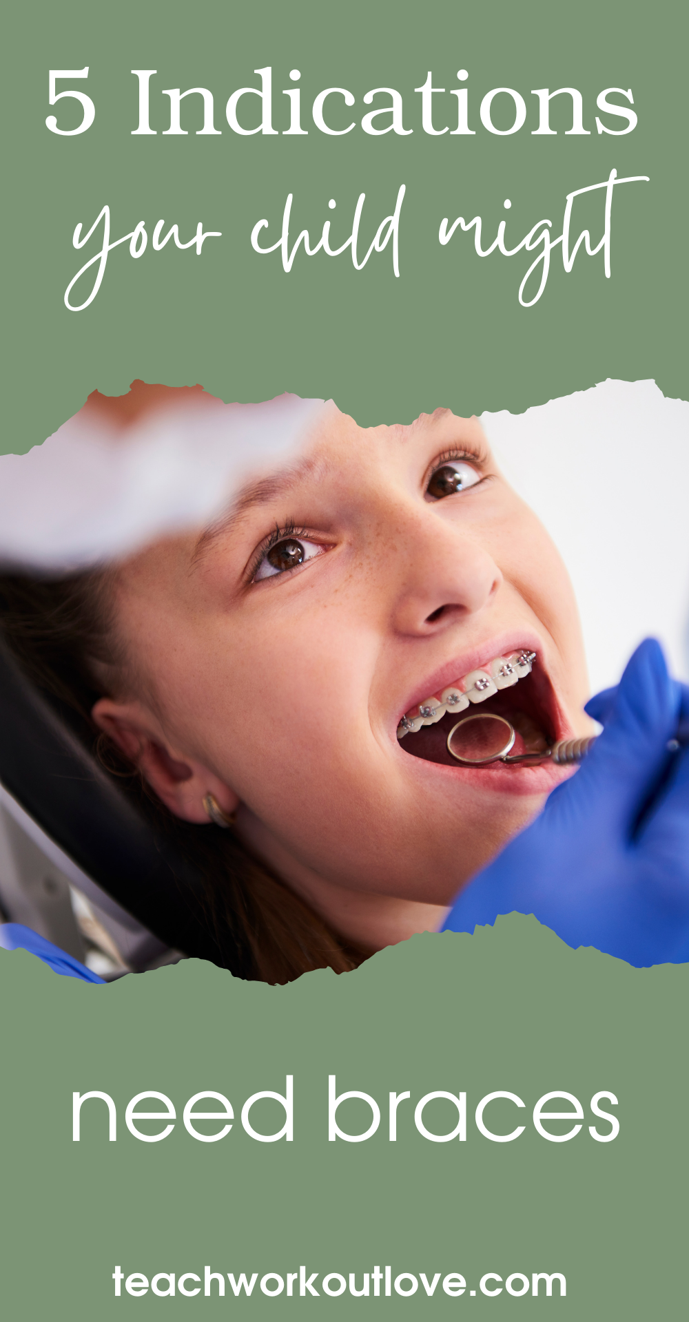 If your child’s teeth aren’t aligned correctly, this can cause an array of issues. Here are some warning signs that your child may need braces.