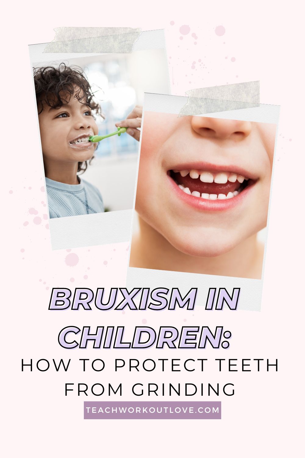 In this article, we will look at the problems associated with bruxism in children and the role of pediatric dentists in protecting their teeth from nightly grinding.